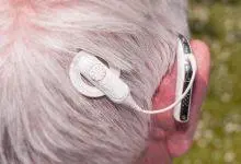 زراعة قوقعة الأذن على رأس شخص