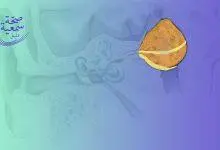 تشريح الأذن مع شمع أذن