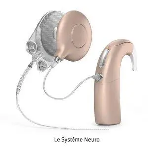 implant oticon system neuro