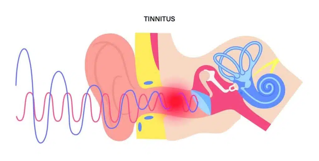 ear disease