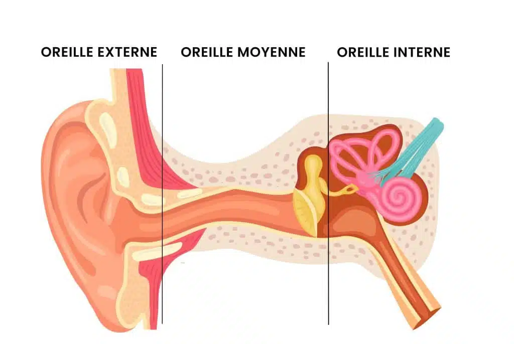 parties oreille surdité