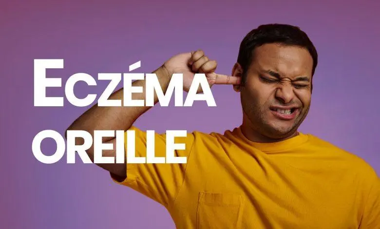 eczema oreille