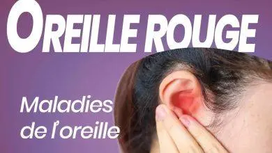 oreille rouge fr