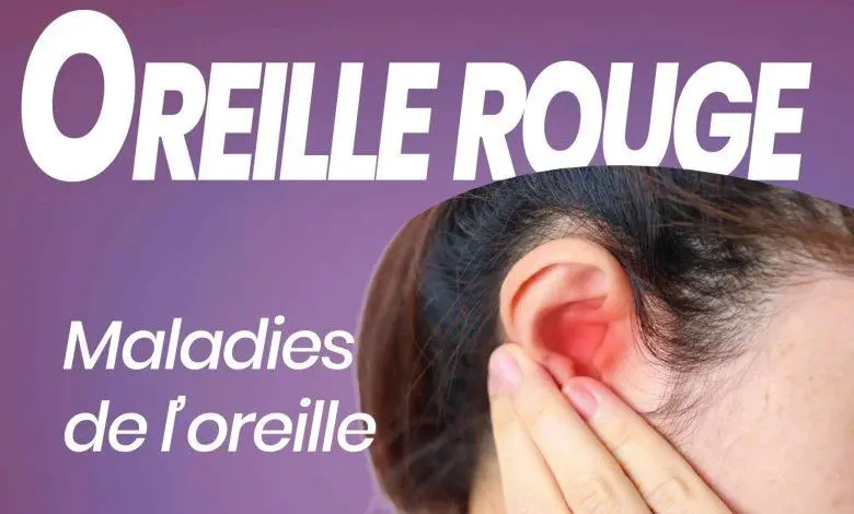 oreille rouge fr