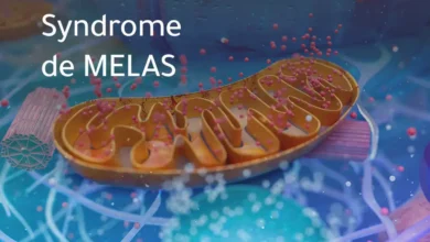 Illustration du syndrome de MELAS, mitochondrie.