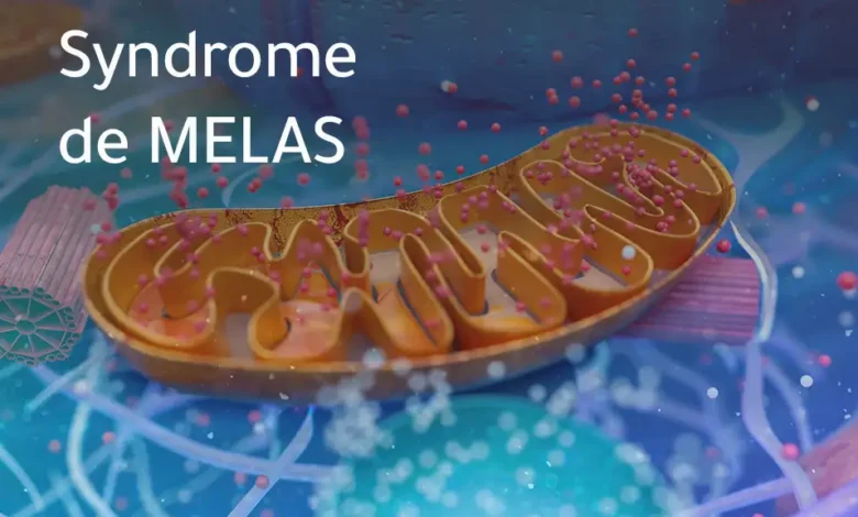 Illustration du syndrome de MELAS, mitochondrie.